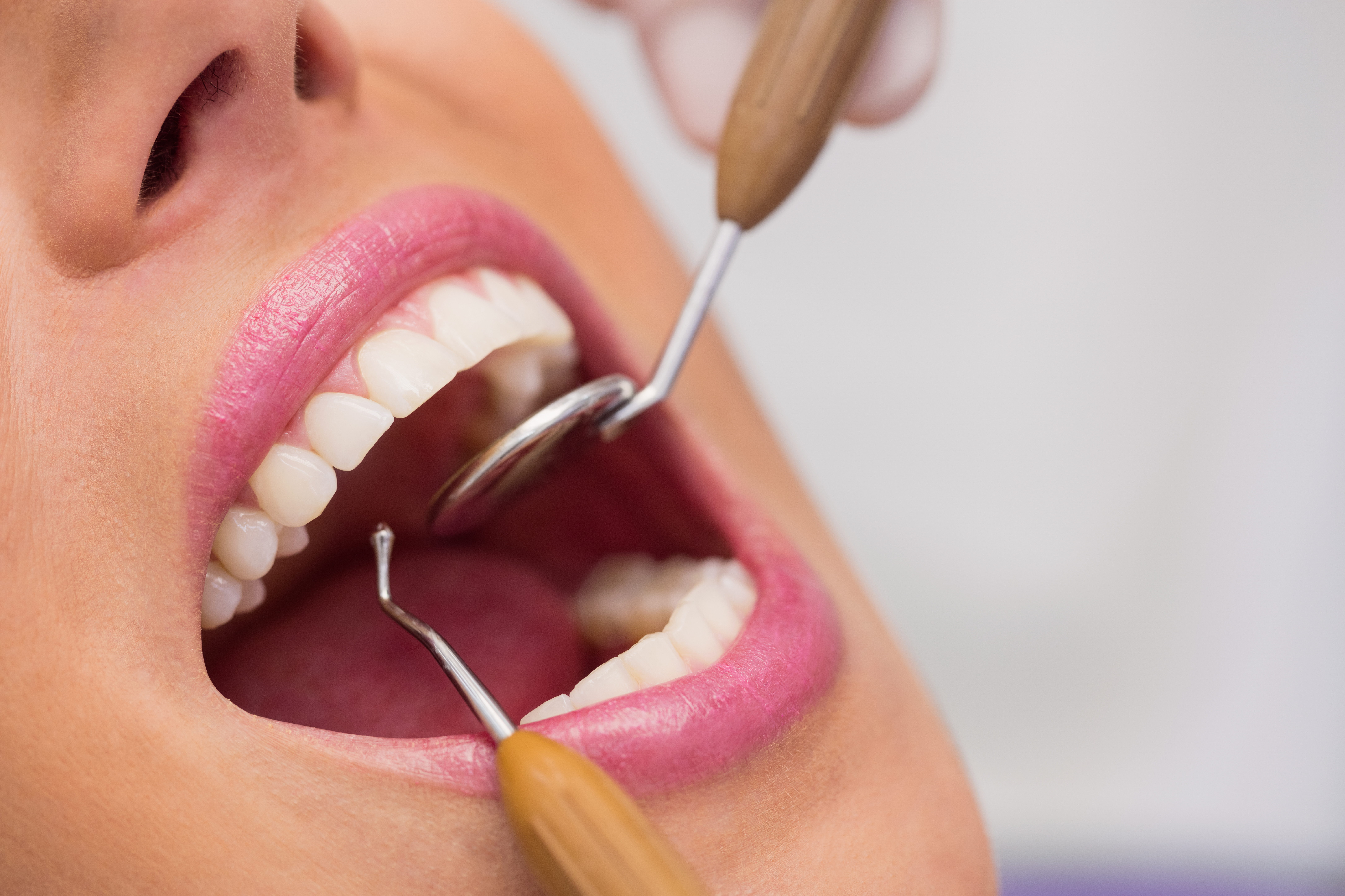 5 RAZONES PARA IR AL DENTISTA